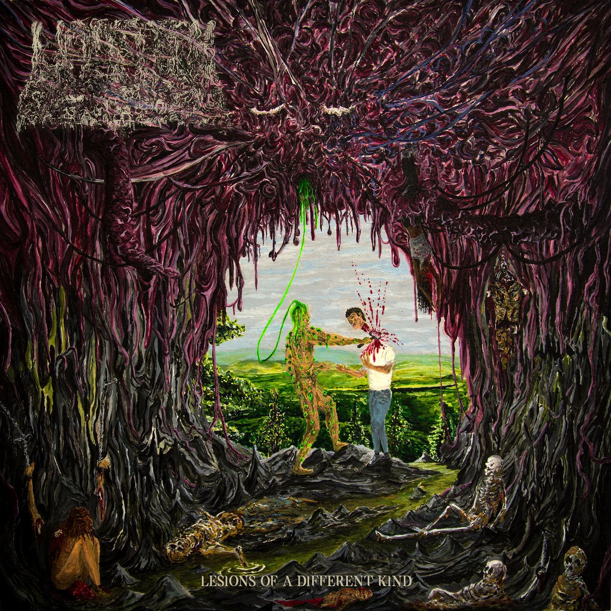 UNDEATH 'LESIONS OF A DIFFERENT KIND' CD